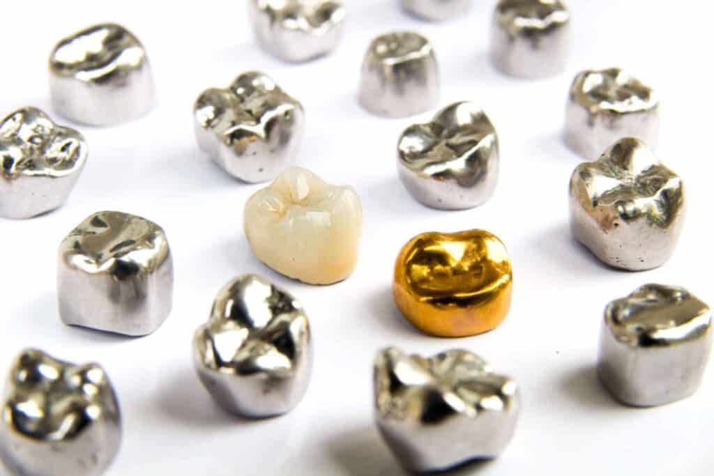gold-silver-dental-crowns-web-scaled Various dental crown options, including gold and metal crowns, for tooth restoration and durability