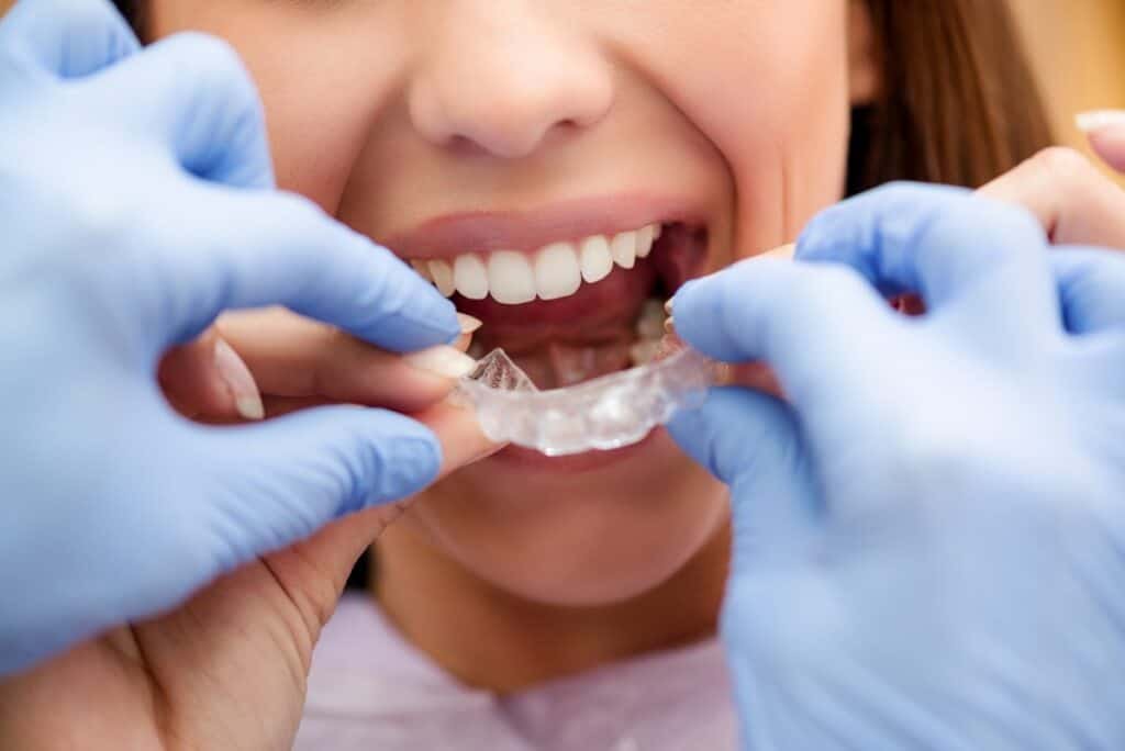 orthodontics-treatment Dentist fitting clear aligners for a patient, illustrating modern orthodontic treatment.