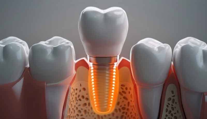 salvage-1 Dentist explaining the cost of dental implants, including factors that influence pricing for patients