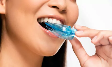 mouthguard-thumb-437x262